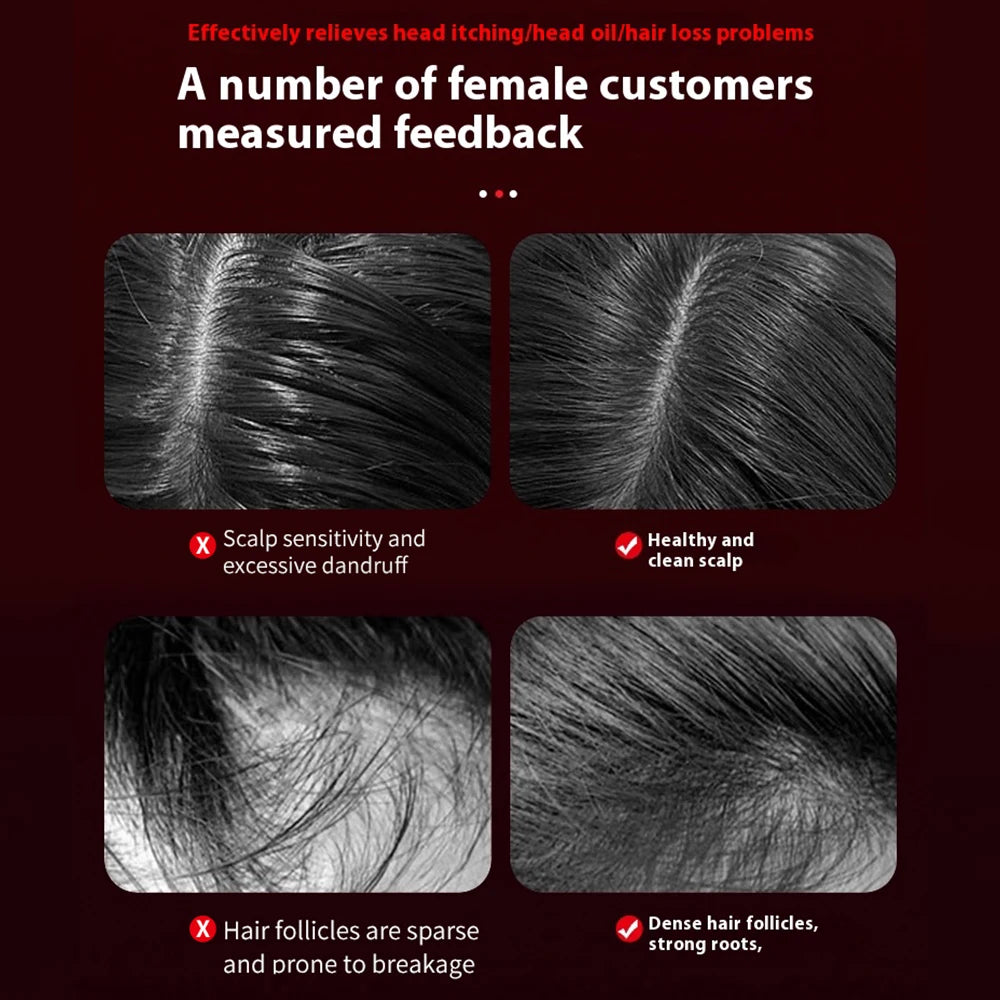 Red Light Therapy Hair Growth Massage Comb