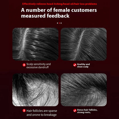 Red Light Therapy Hair Growth Massage Comb