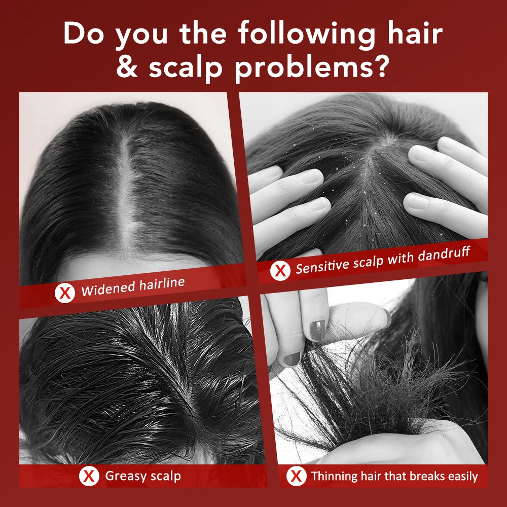 Red Light Therapy Hair Growth Massage Comb